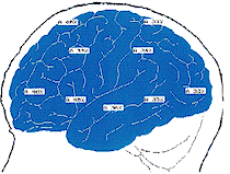 Brain Scan 1 Normal (Ideal) Profile